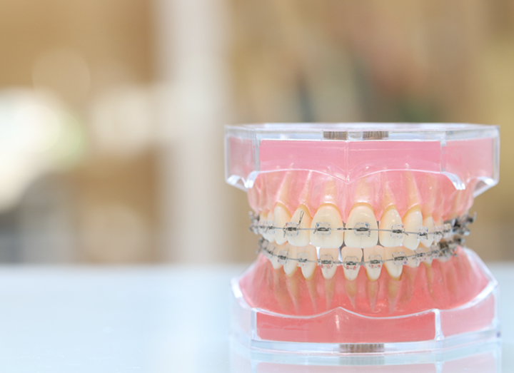 審美歯科（ホワイトニング）・矯正歯科の画像